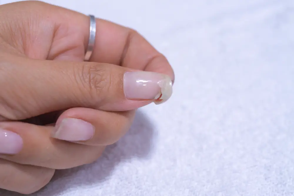 How To Stop Acrylic Nails From Hurting After Removing Them